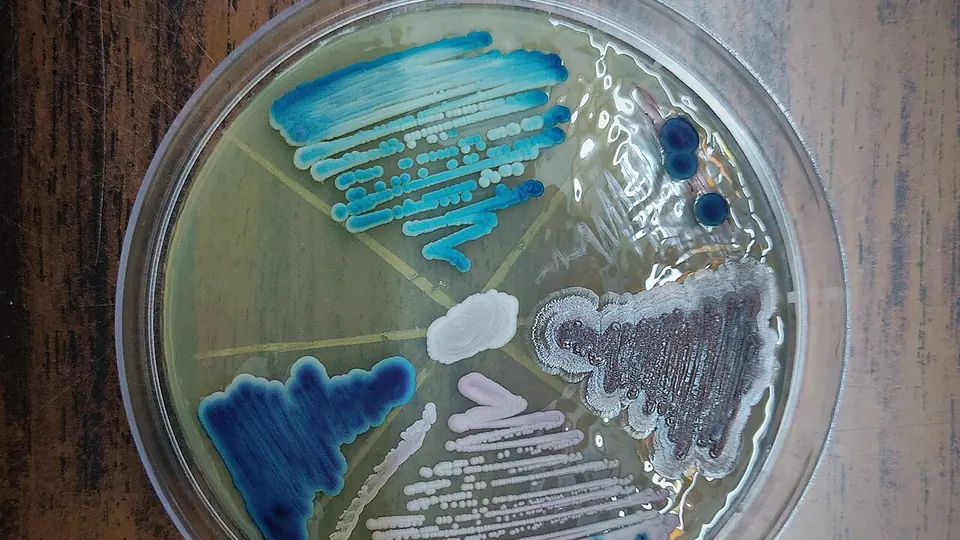 Placa de Petri com colônias de micro-organismos crescendo em meio de cultura