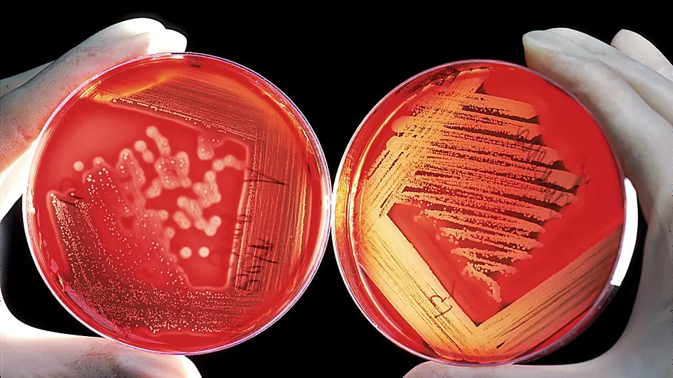 Duas placas de cultura com colônias de bactérias crescendo em meio vermelho