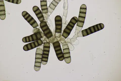 Clamidósporos escuros e segmentados de Berkeleyomyces basicola ao microscópio
